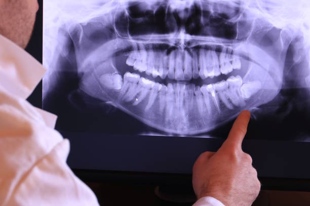 Best Emergency TMJ Treatment in Rockledge, PA